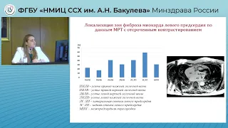 Защита диссертации Аракелян М. Г.