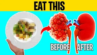 The #1 Food For Toxic Kidneys (you have it in your kitchen)
