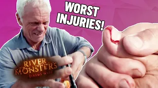 The WORST Injuries! (Part 1) | COMPILATION | River Monsters