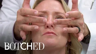 Woman's Nose Bones Are Straight--But Cartilage Is Crooked | Botched | E!