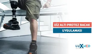 Ottobock Diz Altı Protez Bacak Performansı  | Luxmed Protez