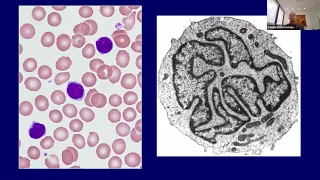 Essential Lymphoma Diagnoses