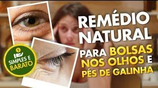 REMÉDIO NATURAL para Bolsas Nos Olhos E Pés De Galinha | Dr. Dayan Siebra