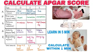 How To Calculate APGAR Score | Pediatrics