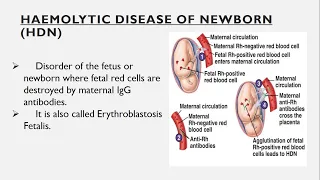 Haemolytic Disease of Newborn HDN | Erythroblastosis fetalis | Midical Notes | Rh Incompatibility