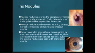 Uveitis Introduction Epidemiology and Classification