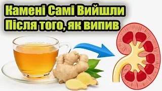 Ось так я без сечогінних та операції вивів камені з нирок простим чаєм