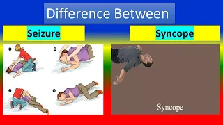 Difference Between Seizure and Syncope