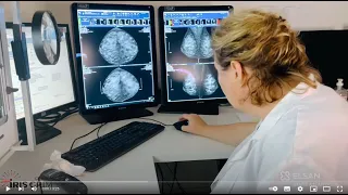 Innovation et expertise avec le nouveau mammographe 3D IRIS Grim - Santé Atlantique