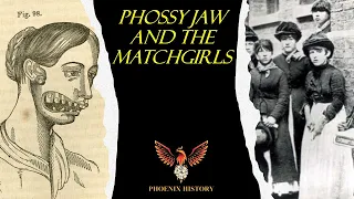 Phossy Jaw And The Matchgirls