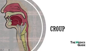 Croup - A Clinical Overview for Medical Students