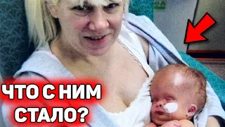 Мальчик родился практически БЕЗ мозга. Как он живет спустя 7 лет?