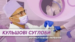 Кульшові суглоби: внутрісуглобове лікування