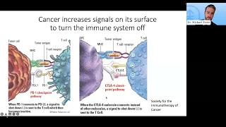 Advances in Genomics & Immunology to Classify and Treat Appendiceal Cancer with Dr. Michael Foote