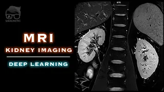 MRI – KIDNEY IMAGING – DEEP LEARNING