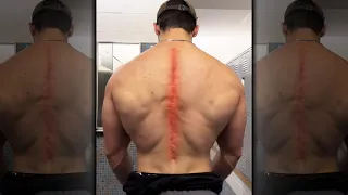 "His Back Is Destroyed..." 🤦‍♂️