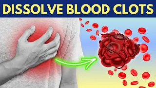 ULTIMATE GUIDE! Top 8 Foods To Prevent and Dissolve Blood Clots