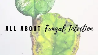 All About Fungal Infection