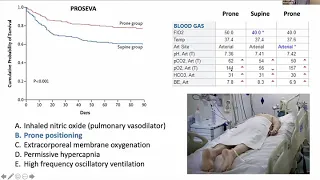 COVID-19 Critical Care Training Forum: Episode 5 - May 12, 2020