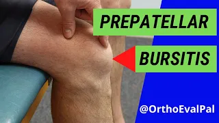 Prepatellar Bursitis (Anterior knee pain and swelling)