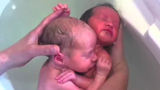 Близнецы в первые несколько минут после рождения