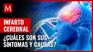 ¿Hay síntomas? ¿Qué es un infarto cerebral y cuáles son sus posibles causas?