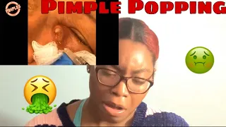REACTING TO BLACKHEADS && PIMPLE POPPING REMOVAL