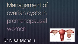 #ovariancysts #gynaecology #premenopausalwomen