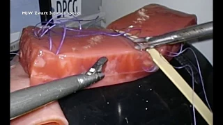 Laparoscopic Surgery - Pancreaticojejunostomy 3D #1 (Suturing Training)