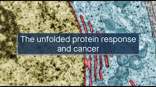 Targeting the unfolded protein response to treat cancer