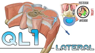 BLOQUEO DEL CUADRADO LUMBAR