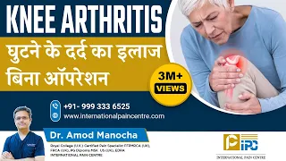 घुटने के दर्द का इलाज बिना ऑपरेशन | Knee Arthritis Pain Treatment | Avoid surgery - Dr. Amod Manocha