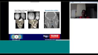 Maxillofacial Trauma Imaging by Dr Anbumalar