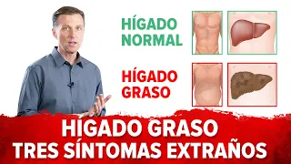 Hígado graso 3 síntomas extraños-Subtitulado