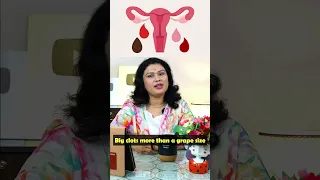 पीरियड्स में ऐसे लक्षण सबसे बुरे होते है - Periods symptoms & Pregnancy  #shorts #youtubesaheli