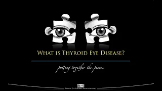 What is Thyroid Eye Disease