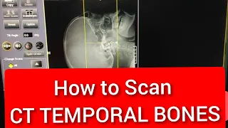 Temporal Bones CT scan Protocol, Positioning & Planning