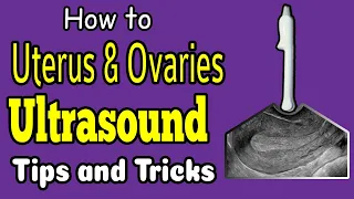 Sonographic Anatomy of the Uterus and Ovaries