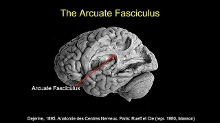 CARTA: Comparative Anthropogeny: Human Arcuate Fasciculus