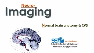 Normal brain radiological anatomy - Prof. Mamdouh Mahfouz