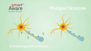 Multiple Sklerose: Entstehungsmechanismen I Fachfortbildungen in der Pflege | smartAware
