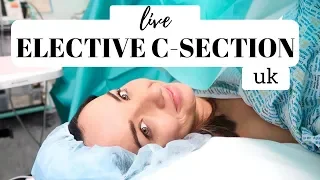 LIVE C SECTION VLOG UK | LIVE CEASAREAN SECTION BIRTH VLOG NHS 2019