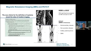 Updates in Managing Bone Disease in Multiple Myeloma | Dana-Farber Cancer Institute