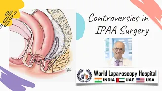 Controversies in IPAA Surgery - Steven D Wexner