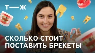 Брекеты: сколько стоит установка, как сэкономить