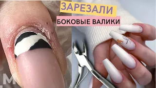 ИСКРОМСАЛИ КУСАЧКАМИ 😖 Сложный маникюр. ПОВРЕЖДЕННАЯ кожа. Наращивание ногтей БАЛЕРИНА💅