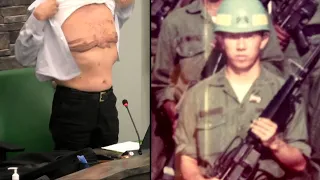 Asian American Politician Explains Why He Showed Scars