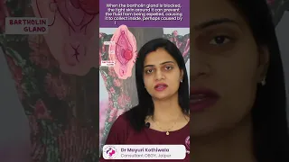 What Causes Bartholin Cyst in Hindi - बार्थोलिन सिस्ट का क्या कारण है? - By Dr. Mayuri Kothiwala