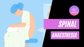 Spinal Anaesthesia for caesarean section