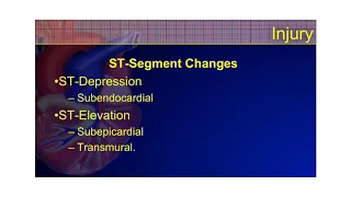 The 12-Lead ECG Course - STEMI Part 2